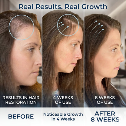 Bodywise Byvirexa Hair Growth  Roll on Serum