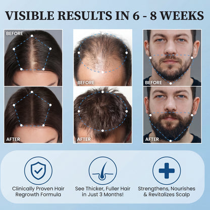 Bodywise Byvirexa Hair Growth  Roll on Serum