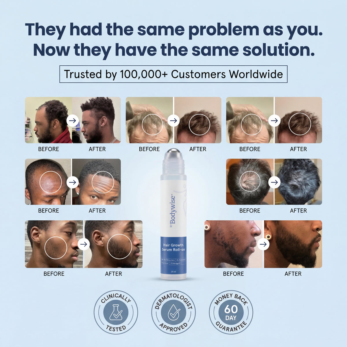 Bodywise Byvirexa Hair Growth  Roll on Serum